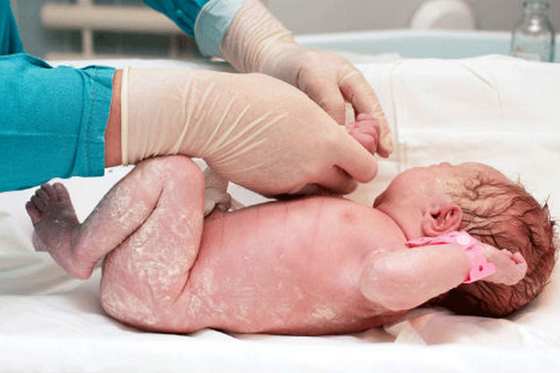 Шелушение кожи у новорожденного