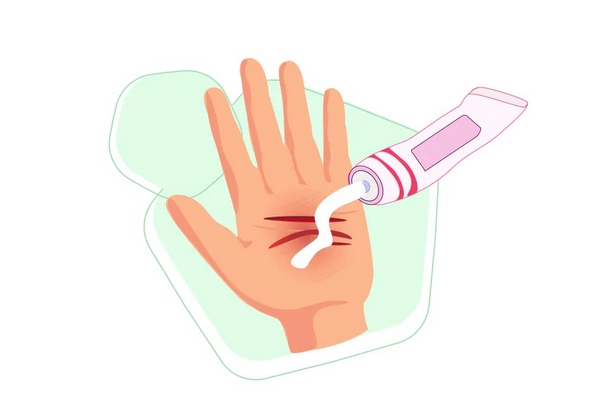 Ранозаживляющие мази: как выбрать средство в конкретном случае