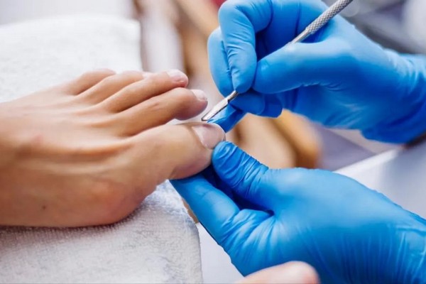 Опасность онихолизиса: Почему эксперты советуют отказаться от гель-лака на ногах зимой