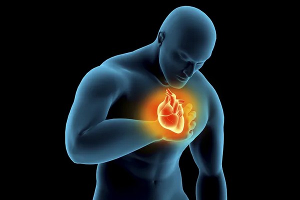 Сердце под ударом: Как хронический стресс разрушает сосуды и вызывает инфаркт