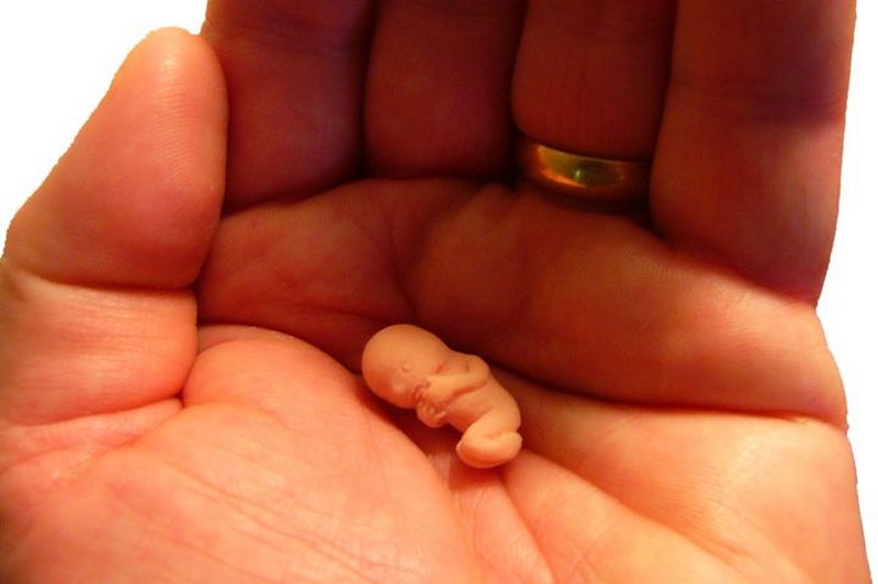 Что такое на самом деле - аборт
