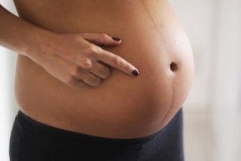 О чем расскажет темная полоска на животе при беременности