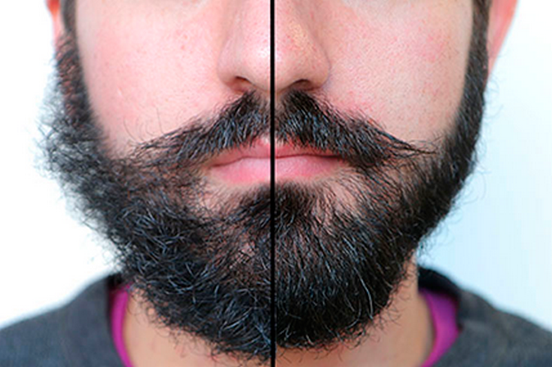 Если долго не бриться борода растет