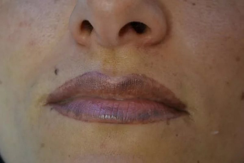 Почему синеют губы