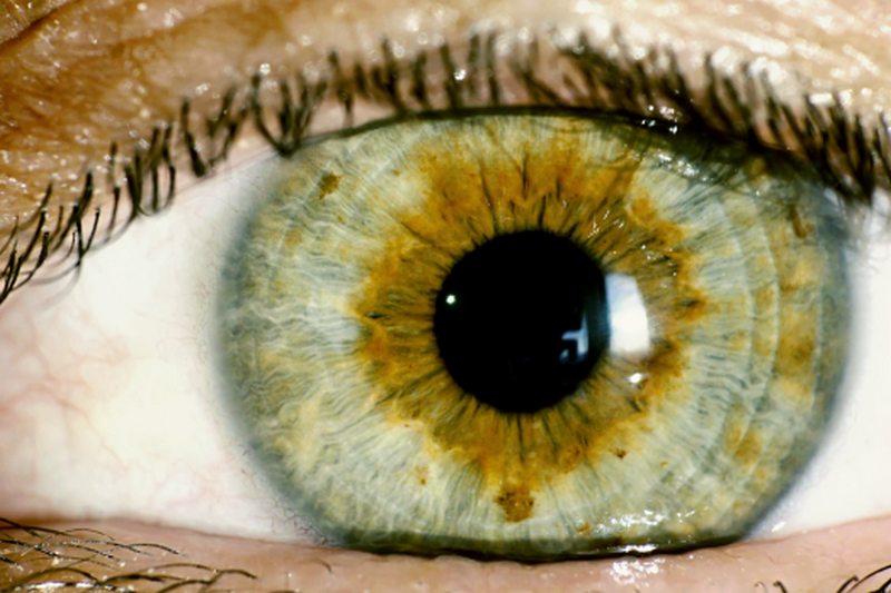Американским ученым удалось вырастить фрагмент сетчатки человеческого глаза .