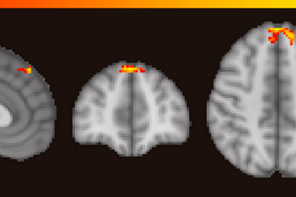 Ученые визуализировали работу мозга при насилии и обмане